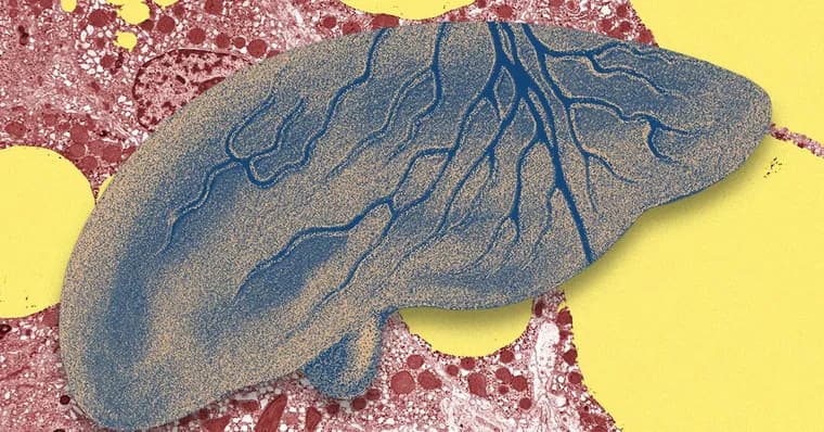 AI learns to spot fatty liver disease in routine blood tests and x-rays